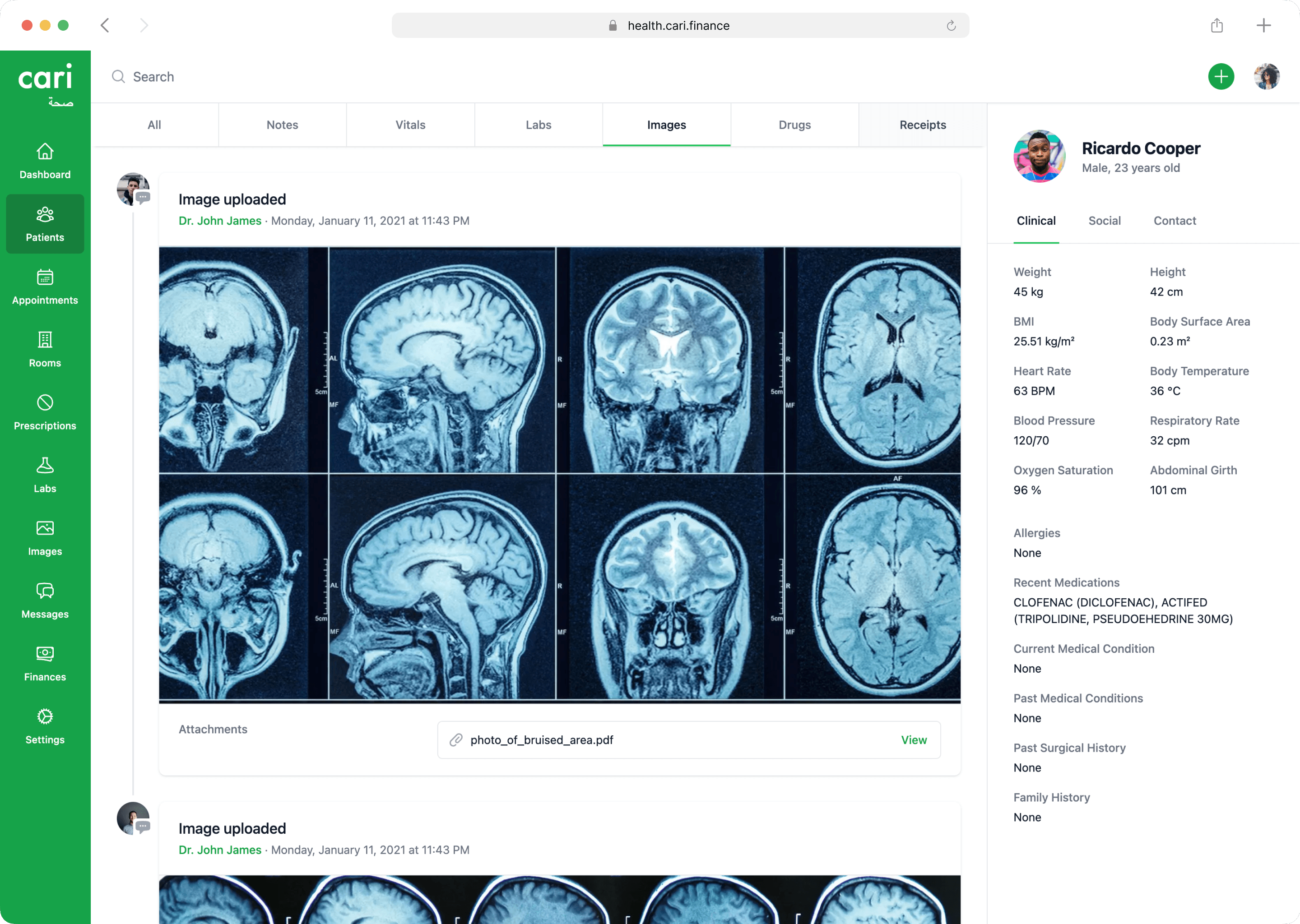 We use machine learning to help you detect early signs of problems more accurately and reduce errors.